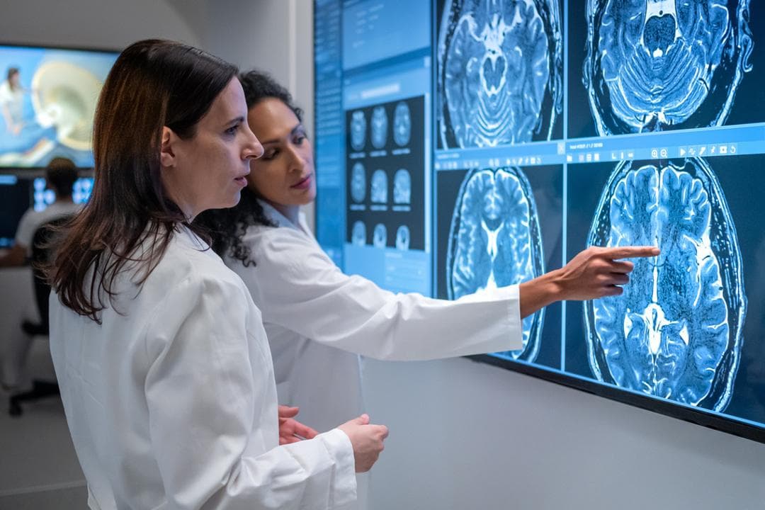 Alzheimer : voici la piste prometteuse explorée par des chercheurs américains pour aider le cerveau à éliminer les plaques amyloïdes
