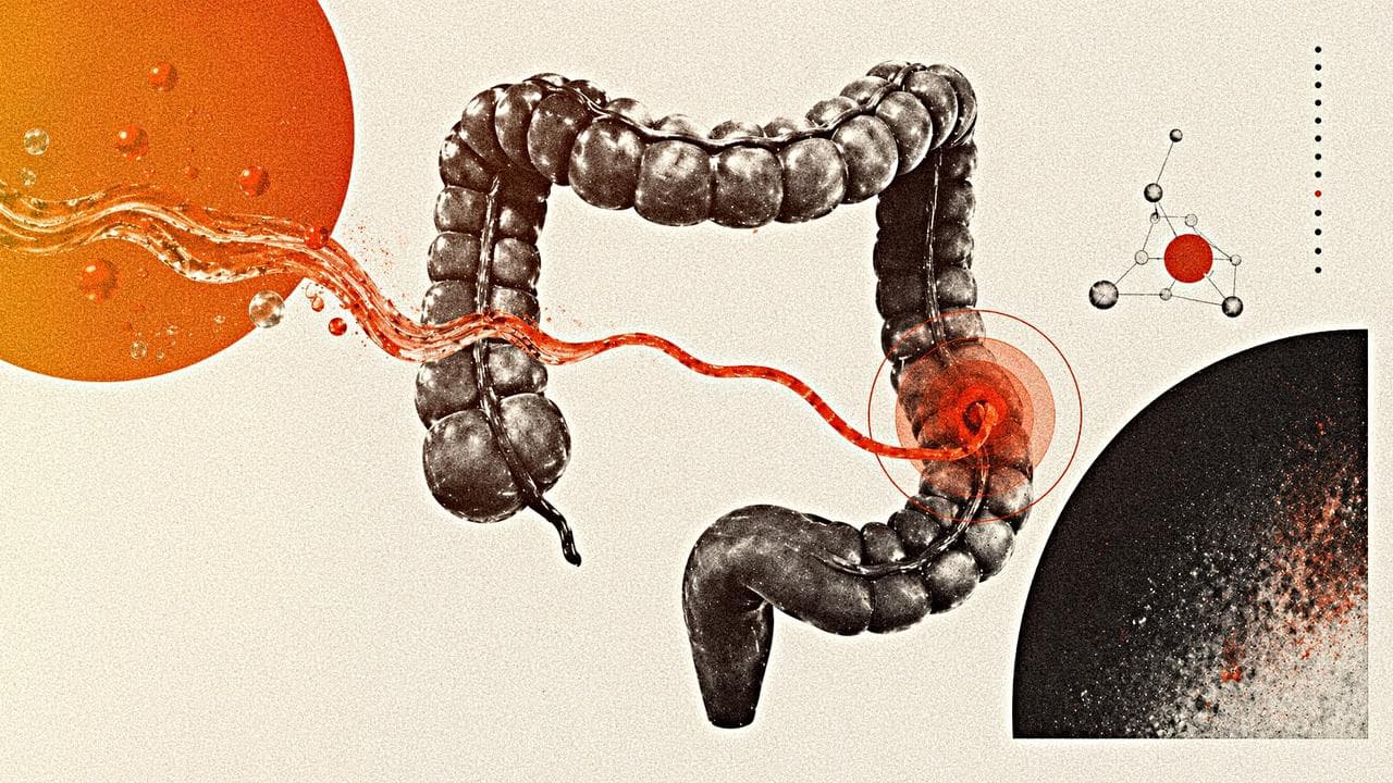Cancer colorectal chez les moins de 50 ans : un herbicide présent dans l’eau ressort dans une étude majeure