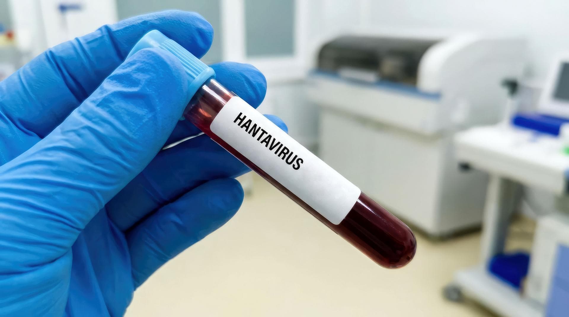 Hantavirus : le virus Andes du MV Hondius était-il devenu mutant ? Le verdict vient de tomber