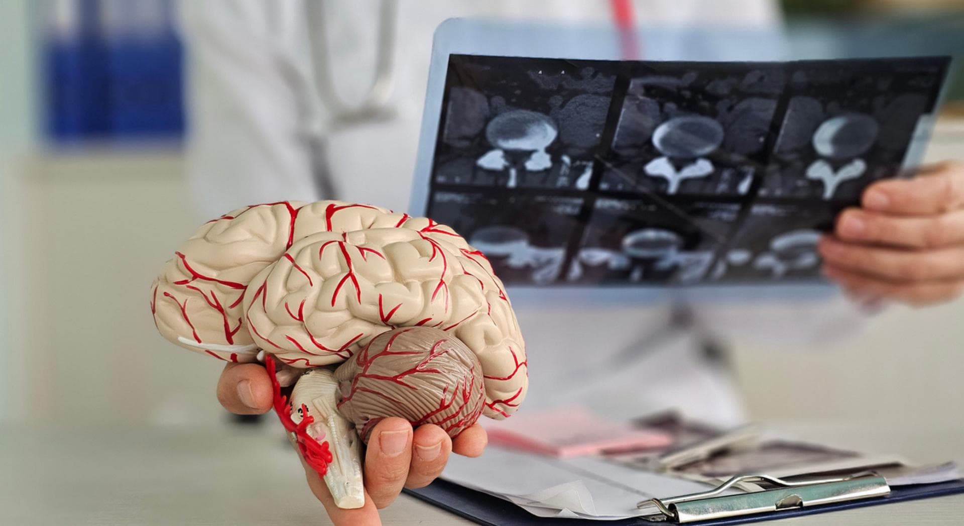 Alzheimer : des scientifiques découvrent un mystérieux « germe » qui pourrait jouer un rôle clé dans la maladie