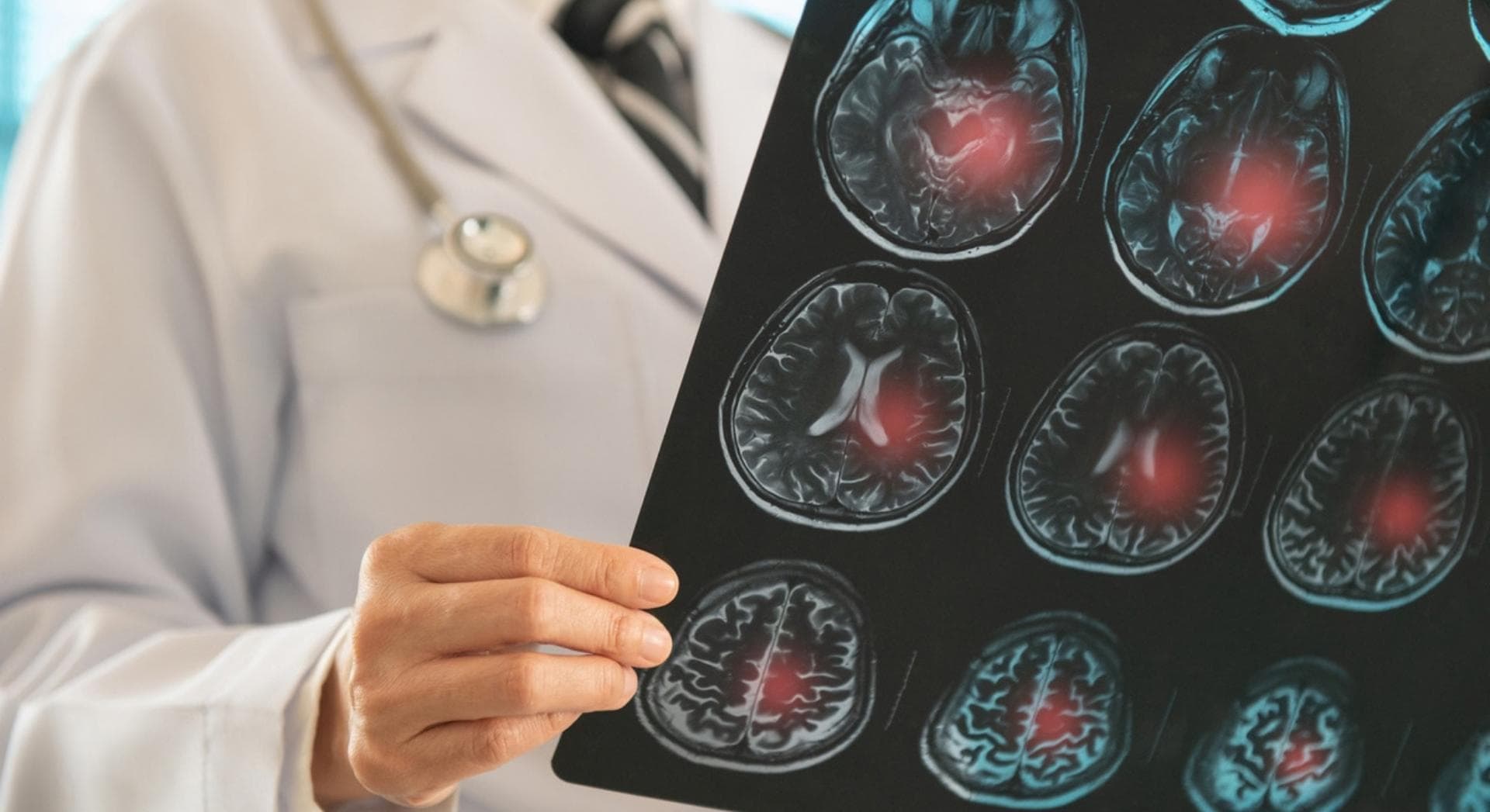Présenté comme sans danger, cet édulcorant connu inquiète les chercheurs
