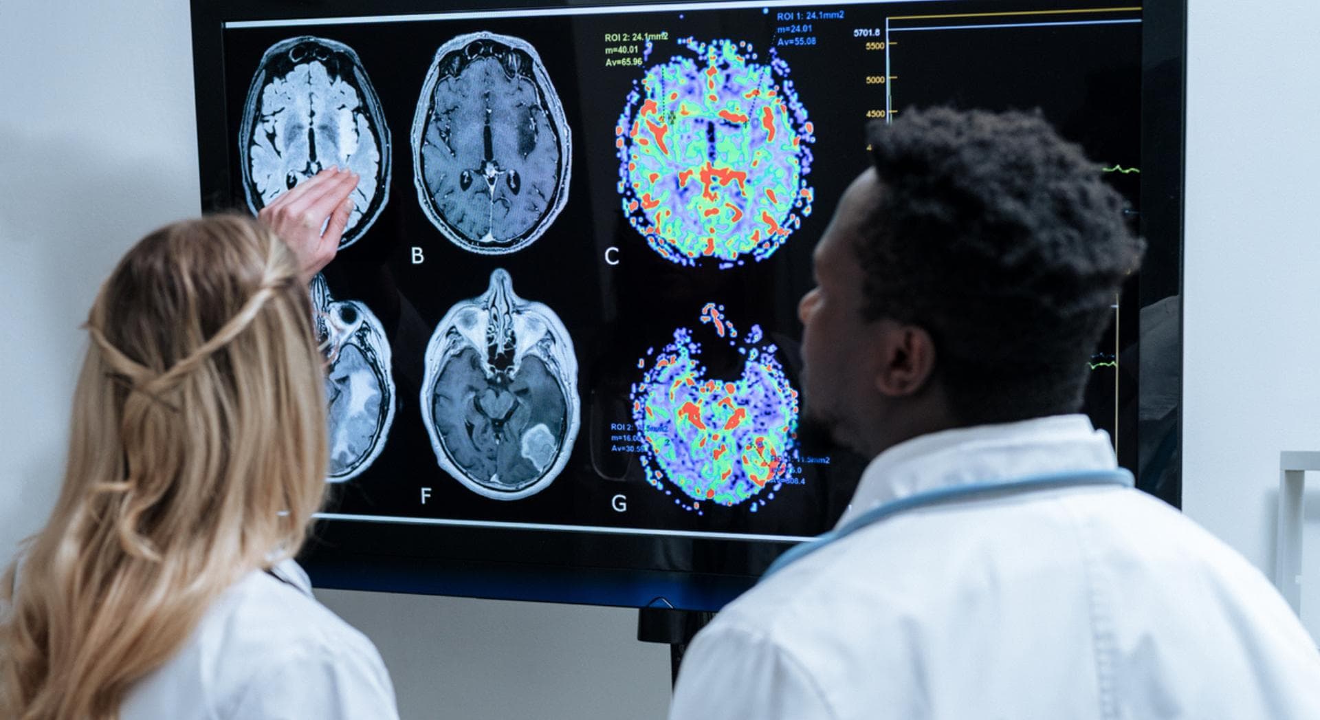 Alzheimer : un simple test de 10 minutes pourrait repérer la maladie jusqu'à 15 ans avant les premiers signes
