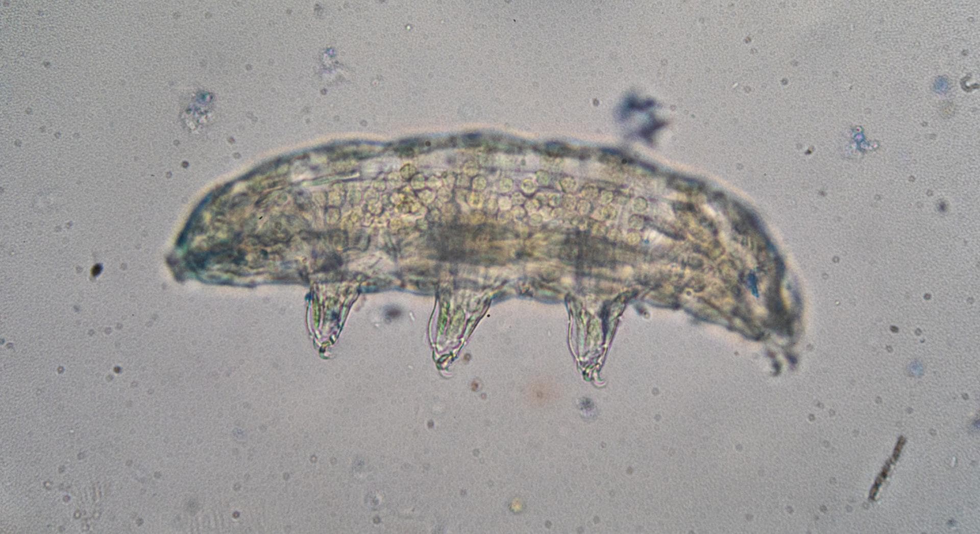 Une seule protéine de tardigrade suffirait à réduire les dommages des radiations sur les cellules humaines : voici comment