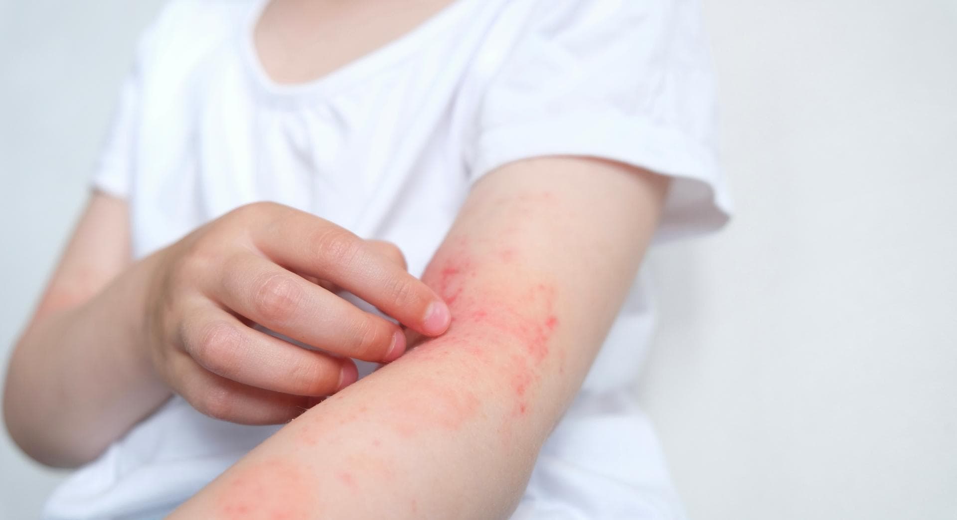 Vous n’allez pas en revenir : ces allergies improbables existent bel et bien